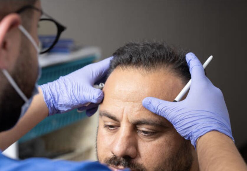 Hair Transplant